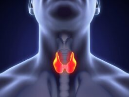 thyroid cancer