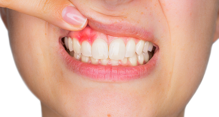 tooth infection treatment