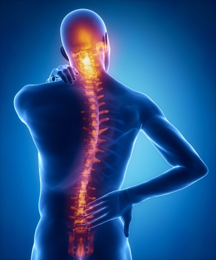 Natural treatments for scoliosis